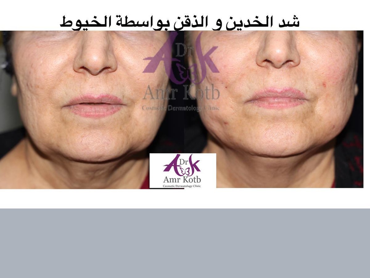 Dr Amr Kotb Dermatology Clinic in Cairo, Egypt Read 38