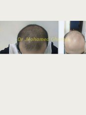 Derma & hair transplantation clinic - محلة زياد ميدان المحطه, اعلى معمل المها لاب, المحلة الكبرى, الغربيه, 31846, 