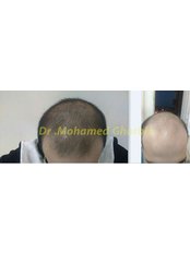 Derma & hair transplantation clinic - محلة زياد ميدان المحطه, اعلى معمل المها لاب, المحلة الكبرى, الغربيه, 31846,  0