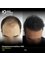 IQ Dermatology Care - IQ SKIN CLINICS - Before and After FUE Hair Transplant  