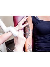 Tattoo Removal - Dr. Kalokasidis Konstantinos - Dermatologist