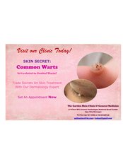 Wart Removal - The Garden Skin Clinic