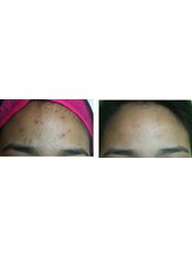 Dermatologist Consultation - Vanity First Skin Center