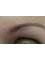 Inskin Group - after microblading 