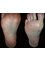 The Harley Medical Foot and Nail Laser Clinic: Marion Yau - 46 Harley Street, London, W1G 9PT,  5