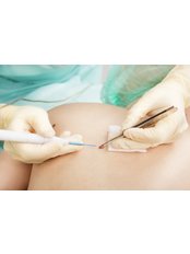 3 x Mole Removal - Roundwell Medical Practice