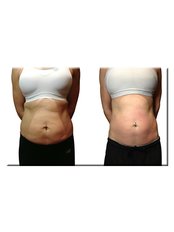 Weight Control - Redefined Skin & Body Clinic