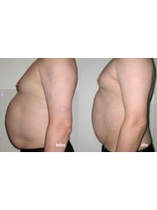 Weight Control - Redefined Skin & Body Clinic