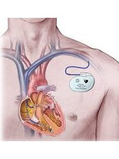 Pacemaker - Integrated Cardiac Center Coimbatore
