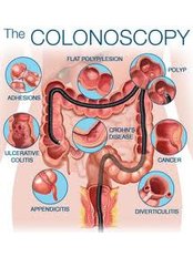 Colonoscopy - Valli Hospital