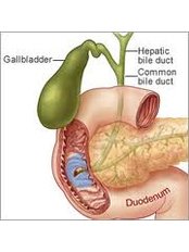 Gallbladder Removal - Valli Hospital