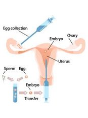 Egg Donor - Fertility Clinic Puducherry