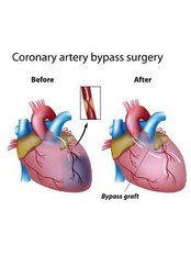 Heart Bypass - The Cardiac Surgeon