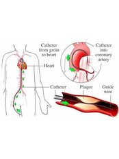 Heart Disease Treatment - The Cardiac Surgeon