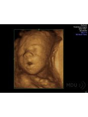 3D / 4D Baby Scan - Medical Diagnostic Ultrasound