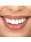 The Phenomenal Way International - Teeth Whitening 
