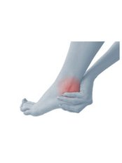 Ankle Injury Treatment - Davenport House Clinic