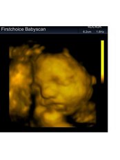 Maternity Consultation - First Choice Baby Scan
