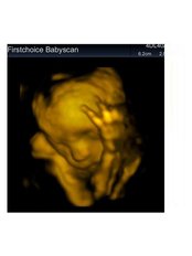 Diagnostic Imaging Consultation - First Choice Baby Scan