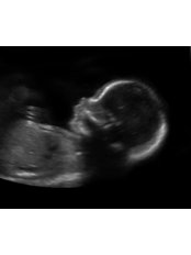 Pregnancy Ultrasound Scans - The Scan Clinic