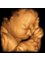 Babybond & Ultrasound Direct Manchester - 4D ultrasound At its very best 