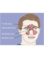 FESS - Functional Endoscopic Sinus Surgery - GV ENT Clinic / The GV Nose clinic