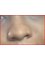 Ent Department Cmh Lahore Cantt - negro nose before surgery 