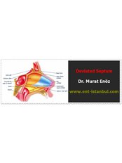 Septoplasty - Dr Murat Enoz, ENT Specialist - Private Office