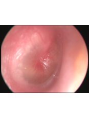 Ear Infection Treatment - Dr. Atilla Sengor
