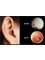 Transform Hearing Ltd - Pre and post treatment Images of the ear 