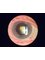 Eye Surgeons SA - Kurralta Park - The Tennyson Centre Level 1, 520 South Road, Kurralta Park, SA, 5037,  1