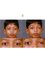 Artificial Eye Co. - 21 RABINDRA SARANI LIUAH NEAR KHEMKA HIGH SCHOOL, 2 Minutes from Liluah Station, Howrah, West Bengal, 711204,  15