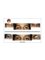 Artificial Eye Co. - Comparison of ready made Artificial eye and custom made artificial eye at Artificial Eye Co 
