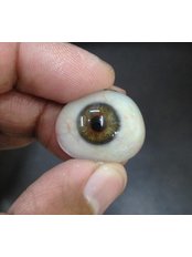 Prosthetic - Eyes - Art Eyes a custom made artificial eye centre