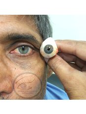 Prosthetic - Eyes - Global Prosthetic Eye Center ,Delhi