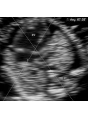 Ultrasound - Embryocosmos Michael Rotas MD Facog