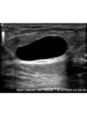 Breast Check - Embryocosmos Michael Rotas MD Facog
