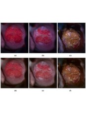 Cervical Check - Embryocosmos Michael Rotas MD Facog