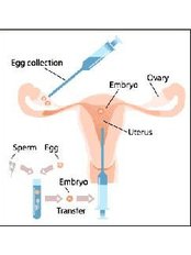 IVF - In Vitro Fertilisation - AKPI - Infertility IVF Treatment - Obstetrics & Gynecology Hospital
