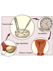 ICSI - Intracytoplasmic Sperm Injection - Select Surrogacy Clinic
