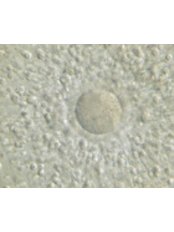 IVF - In Vitro Fertilisation - Ceram
