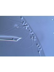 ICSI - Intracytoplasmic Sperm Injection - Ovoclinic