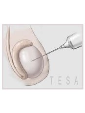 TESA - Testicular Sperm Extraction - Medicana IVF Center in Turkey