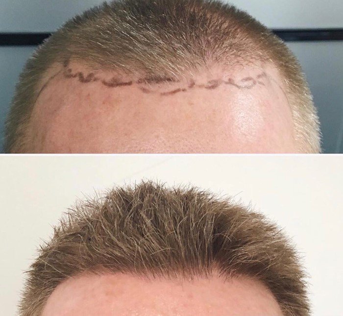 Martinick Hair Restoration Clinic - Melbourne in Toorak