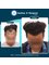 Hairfree & Hairgrow clinic - Ahmedabad - E-295, 2nd Floor, SoBo Centre, Gala Gymkhana Rd,, South Bopal, Bopal, Ahmedabad, Gujarat, 380058,  10