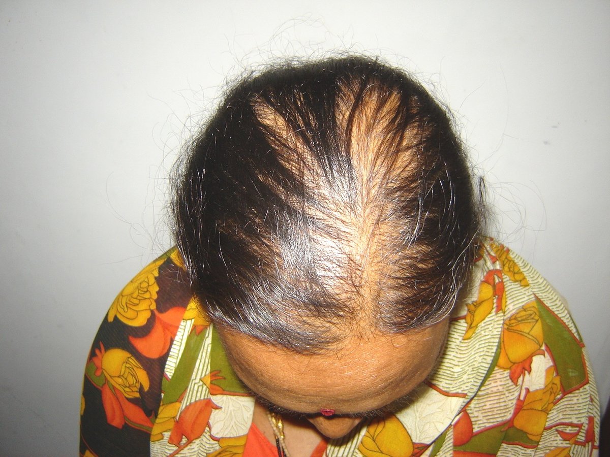 Dr. Rajguru Hair Care&Research Clinic in Aurangabad, India
