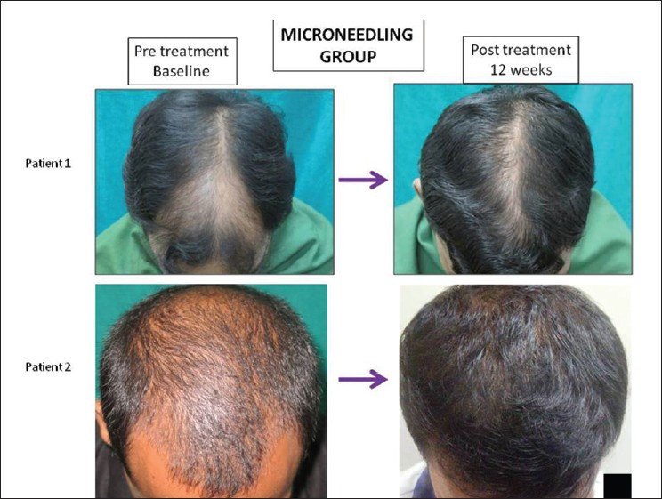 Dermasculpt Skin and Hair Clinic in Bangalore, India • Read 37 Reviews