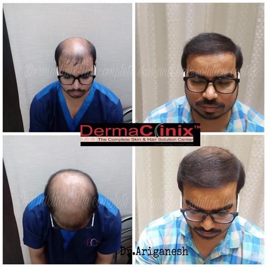 Dermaclinix in Chennai, India • Read 1 Review