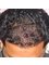 Satyam Hair Transplant Centre Delhi - 862/2 Krishna Nagar, Ludhiana, 141001,  4