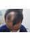 Dr.Khan's exclusive hair transplant center - Banjara Hills - 3rd Floor, Above Kusum, Down town,  Banjara Hills- Road No.1,, Hyderabad, 50000,  4
